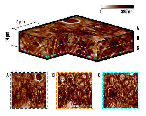 Low coherence IR illumination and z-scan used with Phasics Quantitative Phase Imaging camera enables tomography to reconstruct volumes in tissues